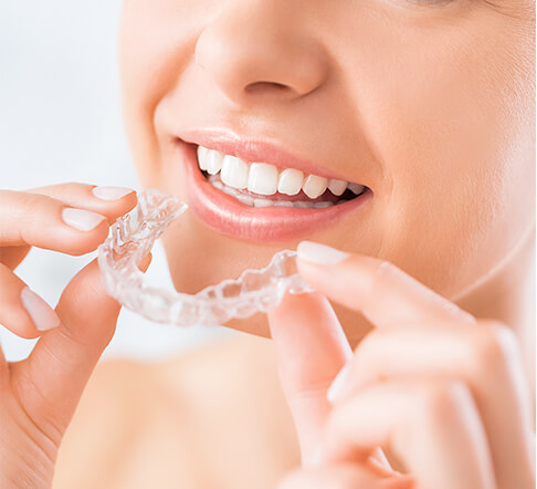 woman inserting clear aligners